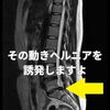 その動き、ヘルニアになりますよ。「この動き、絶対するな！【新潟市 整体 腰痛 肩こり 骨盤矯正 膝痛】」