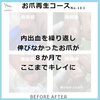 お爪再生コースの８か月後　No.103-1「お爪再生コースの８か月後」