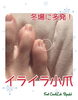 結構気になる！「冬場に多発！イライラ小爪」