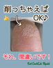 削ればいいってモノじゃない⁈「【角質ケア】削ればいいってモノじゃない⁈」