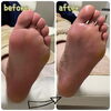 「施術before/after【大分市/】」