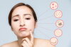 肌トラブルで困る女性「春を迎える前のシミ治療ー美容皮膚科のドクターとナースの対話」