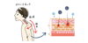 アトピー性皮膚炎の新しいアプローチ「アトピー性皮膚炎を改善！姿勢調整とスキンケアで健やかな肌へ」