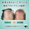 本格発毛育毛スカルプケア横浜市「70代でもあきらめなくて良かった✨」