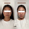 お客様のbefore.after「釧路では数少ない小顔サロン」