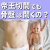 帝王切開と骨盤の話１「【帝王切開でも骨盤は開くの？】」