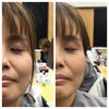 お顔ケアのBeforeAfter「頭痛や首の痛みがある人はほうれい線が深くなる⁈」