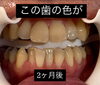 メディカルホワイトニング「メディカルホワイトニング」