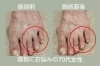 「【足整体】足の裏の痛みにお悩みの70代女性【外反母趾や巻き爪、足の悩み専門整体/千葉県船橋市西船徒歩2分】」