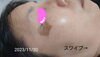 この日からシミケアスタート！現在の画像はスワイプ→「シミケア始めるなら汗をたくさんかく季節の前がオススメ★画像スワイプしてみてください！！空き状況最新版💁」