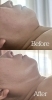 ドライヘッドスパでフェイスラインの変化「ドライヘッドスパで小顔・たるみケア*Flat Relaxation Salon(フラットリラクゼーションサロン)@青梅市河辺町」