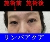 「目もパッチリと大きく♪」