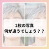 メディカルホワイトニング「もう歳だから…」