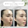 「連休中にオススメしたい“攻めのスキンケア”って？」