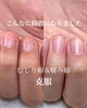 「むしり癖&噛み癖【福井/自爪育成/深爪】」