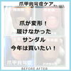  No.105ー１「履けなかったサンダル、今年は買いたい。 No.105」