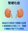 腎硬化症による腎機能低下に注意「腎硬化症による腎機能低下に漢方薬【妙典・行徳エリアの漢方相談薬局】」