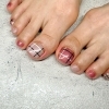 夏のフットネイルに向けて巻き爪ケアを続けたお客様「巻き爪専用ジェルで快適フットネイル！巻き爪ケアのあとはおしゃれも楽しめます」