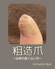 出来の良くない爪は…「【ネイルケア】粗造爪〜出来の良くない爪〜」