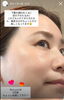 切らない美容整形「【松江/エステ】コンプレックはむくみ下膨れ顔【エイジングケア/肩こり/毛穴】」