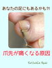 爪棘（そうきょく）「【足爪ケア】いつの間にか⁈痛〜いトゲ‼︎」