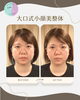 「顔のむくみ・たるみに◎大口式小顔美整体でパッチリ目元体験」
