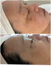 40代からのエイジングケア「【松江/エステ】】その“老け見え”、実は肌のSOSかも。【エイジングケア/肩こり/毛穴】」