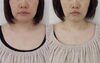 「むくみを解消してたるも予防＆改善【福井小顔/福井たるみ改善/福井フェイシャルエステ】」