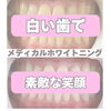 メディカルホワイトニング「変化♡」