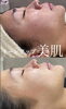 「シェービングは肌の土台作り💪【福島区シェービングエステサロン/大阪頭浸浴】」