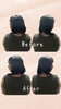 「かっさ施術のBefore→After 首肩ラインの変化を写真でご紹介」