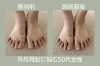 「【足整体】外反母趾でお悩みの50代女性」