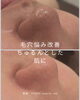 毛穴洗浄で毛穴をきれいに♪「毛穴悩みはTHREEにお任せ！毛穴洗浄×光フォト×ハーブピーリングでちゅるんと艶肌に♡」