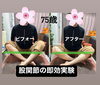 「本格台湾式足つぼ 「ビフォー＆アフター」」