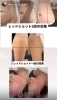 「韓国最新美容⭐︎脂肪溶解とエイジングケア」