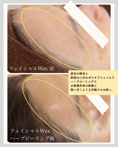 ビフォーアフター「体験コースで実感!お肌の変化とお客様のリアルな声」