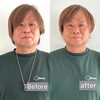 60代　男性　ビフォーアフター✨「脳波と軸を整えて印象チェンジ！お顔のビフォーアフター公開【札幌北区篠路プライベートサロン　Te-tora】 美軸・数霊術カウンセリングも好評！脳波と骨格を整え睡眠の質を上げる安眠エステ」