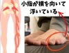 坐骨神経痛と足指の関係「坐骨神経痛と足指の関係とは！？」