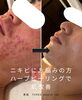 ニキビ・肌荒れケアにホワイトハーブピーリング【肌質改善】【肌荒れ
