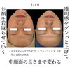 即効性のリフトアップで効果もすぐわかります✨「【🍂秋に増える“肌の乾燥・くすみ”に】夏の疲れ肌におすすめ！秋のうるおいケア✨愛媛県松山市のTiAMにてフォトフェイス＆プラズマフェイシャル体験実施中🙌」