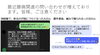 注意報⚠️「腰痛関連のお問い合わせが増加中—ご利用者様の声とご注意のご案内」