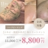 「11月末まで！陶肌トリートメント＆ハーブピーリング特別キャンペーン実施中」