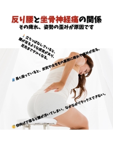 コラム「💥 åり腰ã¨å骨神経痛ã®é–¢ä¿‚: ãã®ç—ºã‚Œã€å§¿å‹¢ã®æªã¿ãŒåŽŸå› ã§ã™ã€