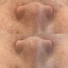 「毛穴だけでなくシワも目立たなく！【 福井フェイシャル/福井エステ/復元フェイシャル/毛穴改善/美白/血行促進 】」