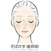 そばかすイラスト「そばかす（雀卵斑）について ― 美容皮膚科のドクターと看護師の会話 ―」