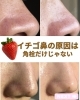 「イチゴ鼻🍓綺麗にしませんか✨」
