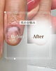 「爪のbefore/after【福井/自爪育成/ネイルサロン】」