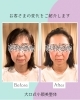 施術前施術後「驚きの変化！大口式小顔美整体でフェイスラインすっきり＆目もぱっちり」