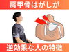 「肩甲骨はがしたらダメな人とは？｜理学療法士が語る肩甲骨はがしでも変わらない人とは？【松江・出雲・米子・整体・根本改善】」