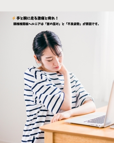 コラム「⚡️ 手と腕に走る激痛と痺れ! 頚椎椎間板ヘルニアは「首の歪み」と「不良姿勢」が原因です。 」